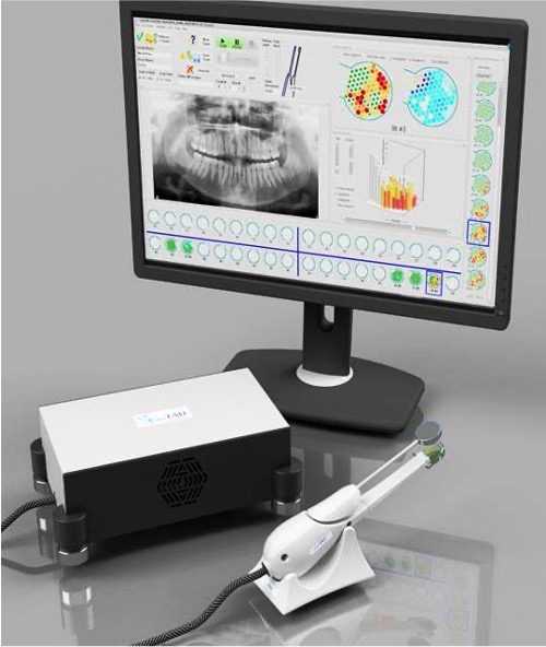 FDOK - und NICO-Diagnostik beim Umwelt-Zahnarzt in Mainz - ganzheitliche Behandlung mit Ultraschall und Toxinausleitung