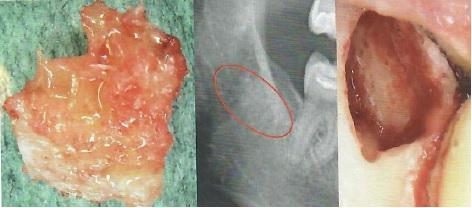 FDOK-Diagnostik mit CaviTAU bei Zahnarzt Dr. Dilaver in Mainz - moderne CaviTAU- und DVT-Bildgebung für ganzheitliche Zahnmedizin